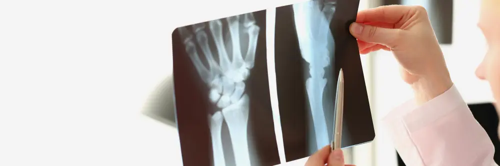 реабилитации после перелома головки лучевой кости